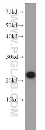 RGS10 Antibody in Western Blot (WB)