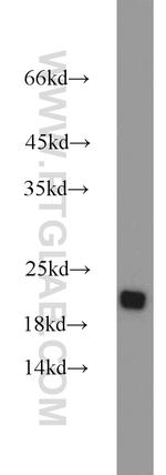 RGS10 Antibody in Western Blot (WB)
