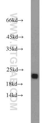 RGS10 Antibody in Western Blot (WB)