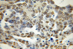 PCTP Antibody in Immunohistochemistry (Paraffin) (IHC (P))