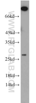 PCTP Antibody in Western Blot (WB)