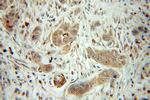 ARHGAP1 Antibody in Immunohistochemistry (Paraffin) (IHC (P))