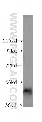 ARHGAP1 Antibody in Western Blot (WB)