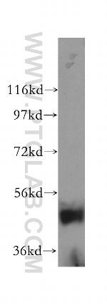 ARHGAP1 Antibody in Western Blot (WB)