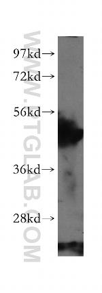 ARHGAP1 Antibody in Western Blot (WB)
