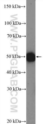 ARHGAP1 Antibody in Western Blot (WB)