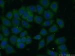 ARHGAP1 Antibody in Immunocytochemistry (ICC/IF)