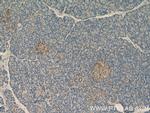 ARHGAP1 Antibody in Immunohistochemistry (Paraffin) (IHC (P))