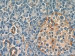 ARHGAP1 Antibody in Immunohistochemistry (Paraffin) (IHC (P))