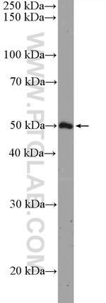 ARHGAP1 Antibody in Western Blot (WB)