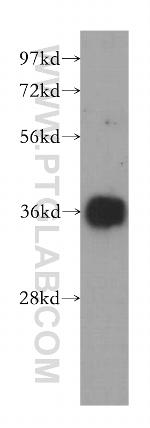 EIF2S1 Antibody in Western Blot (WB)