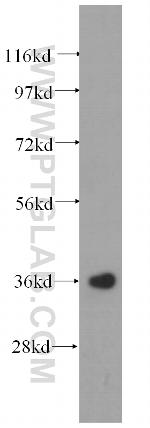 EIF2S1 Antibody in Western Blot (WB)