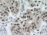 EAF2 Antibody in Immunohistochemistry (Paraffin) (IHC (P))