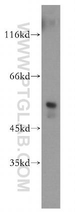 FKBP8 Antibody in Western Blot (WB)