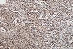 HNRNPA1 Antibody in Immunohistochemistry (Paraffin) (IHC (P))