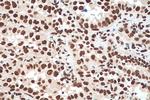 HNRNPA1 Antibody in Immunohistochemistry (Paraffin) (IHC (P))