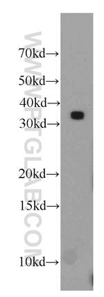 HNRNPA1 Antibody in Western Blot (WB)