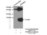 TIMM8A Antibody in Immunoprecipitation (IP)