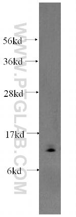 TIMM8A Antibody in Western Blot (WB)