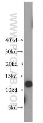 TIMM8A Antibody in Western Blot (WB)