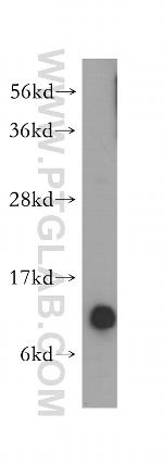 TIMM8A Antibody in Western Blot (WB)