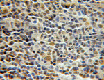 PCNP Antibody in Immunohistochemistry (Paraffin) (IHC (P))