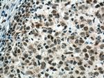PCNP Antibody in Immunohistochemistry (Paraffin) (IHC (P))