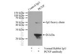 PCNP Antibody in Immunoprecipitation (IP)