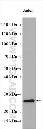PCNP Antibody in Western Blot (WB)