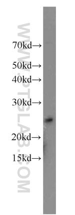 PCNP Antibody in Western Blot (WB)