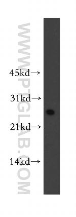 PCNP Antibody in Western Blot (WB)
