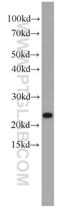 PCNP Antibody in Western Blot (WB)