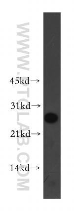 PCNP Antibody in Western Blot (WB)