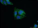 NUDT6 Antibody in Immunocytochemistry (ICC/IF)