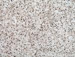 PMF1 Antibody in Immunohistochemistry (Paraffin) (IHC (P))