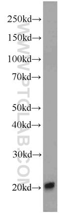 EIF1AY Antibody in Western Blot (WB)