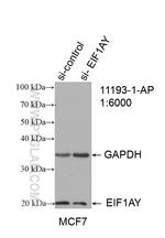 EIF1AY Antibody in Western Blot (WB)