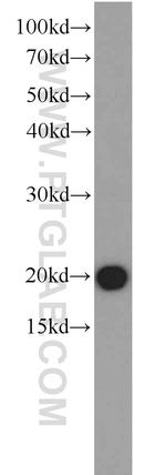 EIF1AY Antibody in Western Blot (WB)