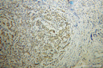 AKR1C3 Antibody in Immunohistochemistry (Paraffin) (IHC (P))