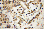 AKR1C3 Antibody in Immunohistochemistry (Paraffin) (IHC (P))
