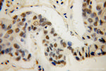 AKR1C3 Antibody in Immunohistochemistry (Paraffin) (IHC (P))