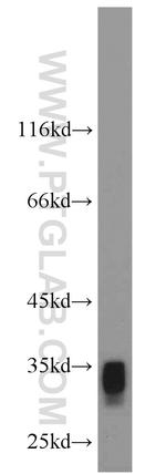 AKR1C3 Antibody in Western Blot (WB)