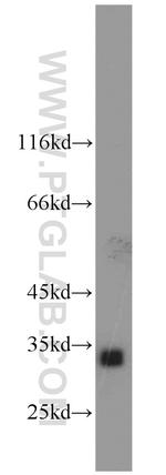 AKR1C3 Antibody in Western Blot (WB)