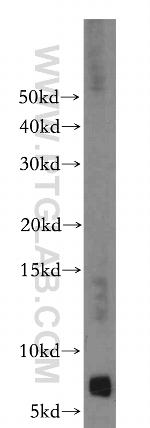 FXYD2 Antibody in Western Blot (WB)