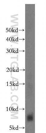 FXYD2 Antibody in Western Blot (WB)