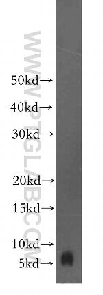 FXYD2 Antibody in Western Blot (WB)