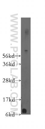 FXYD2 Antibody in Western Blot (WB)