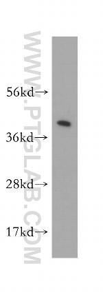 Actopaxin Antibody in Western Blot (WB)