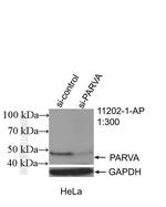 Actopaxin Antibody in Western Blot (WB)
