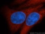 ENO1 Antibody in Immunocytochemistry (ICC/IF)